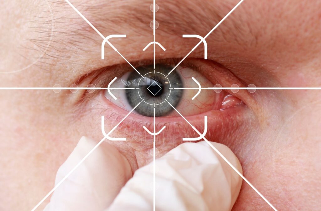 A close up of an eye, with white lines like a scan, landing on the pupil